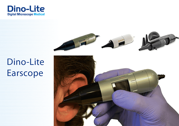 Otoscope - Microscopes USB digitaux- Dino Lite Médical